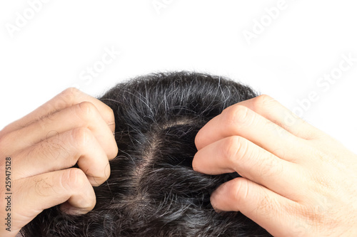 Grey hair on theyoung man head. Hair Dye Product Concept.