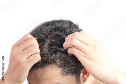 Grey hair on theyoung man head. Hair Dye Product Concept.