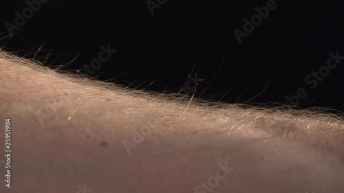 Closeup of a man’s arm as the arm hairs rise up. Could be the result of fear, cold or strong emotion. photo