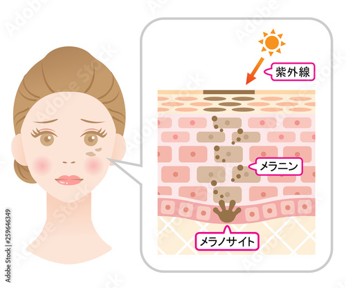 しみの構造　女性の顔と肌の断面図