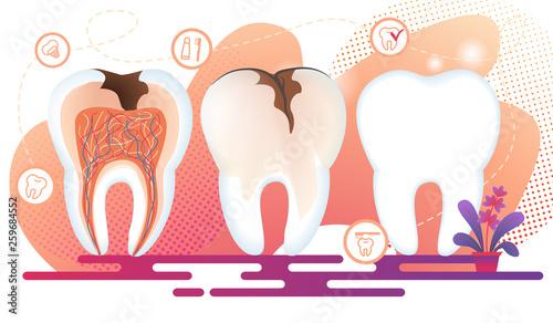 Healthy and Unhealthy Teeth Stand in Raw. Decay.