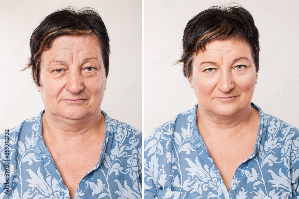 comparison portrait of a mature woman before and after anti-aging procedures. skin care. rejuvenation and cosmetology comparison portrait of a mature woman before and after anti-aging procedures. skin care. rejuvenation and cosmetology