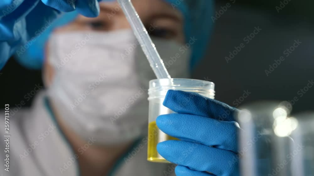 Doctor examining an urine sample Doctor examining an urine sample