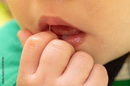 Closeup view of a young child with fingers in mouth