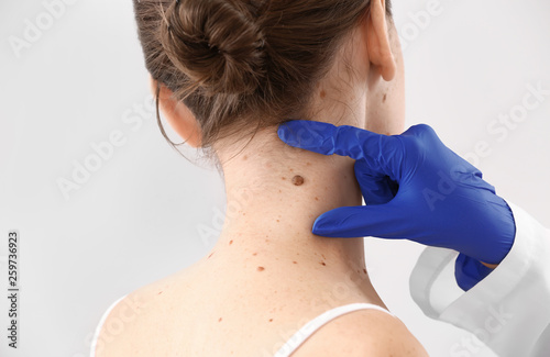 Foto Dermatologist examining moles of patient on light background