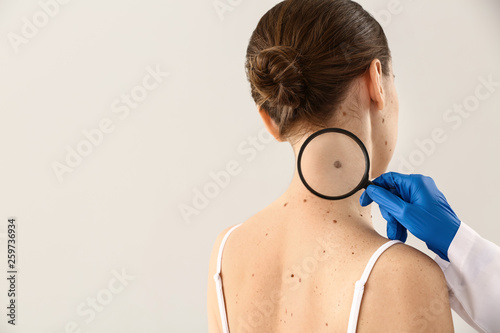Dermatologist examining moles of patient on light background photo