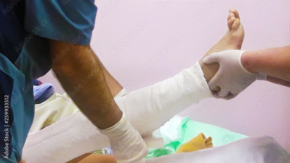 A doctor bandages a broken leg to a patient. Mobile photo. A doctor bandages a broken leg to a patient. Mobile photo.