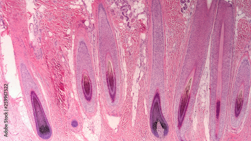 Photomicrograph of cross section human scalp showing histology of hair follicles.   photo