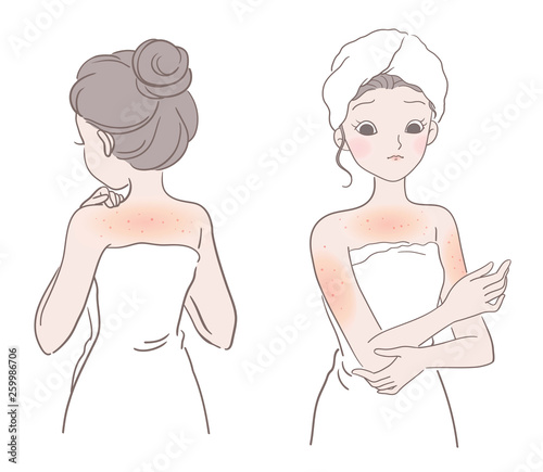 Folliculitis on a woman's skin