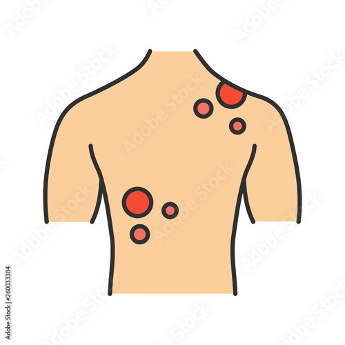 Skin cancer color icon