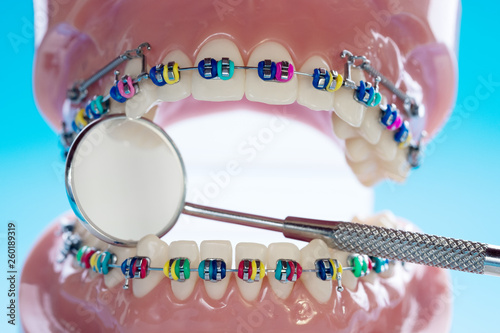 Close up dentist tools and orthodontic model - demonstration teeth model of varities of orthodontic bracket or brace
