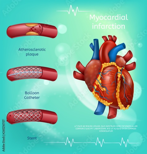 Banner Image Realistic Blood Vessels Human Heart