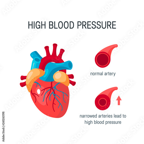 Blood pressure concept in flat style, vector