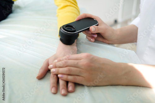 Female dermatologist using a professional dermatoscope while doing skin examination, Checking benign moles on hand. Dermatologist examining birthmarks and moles on a female patient. Dermatology Clinic