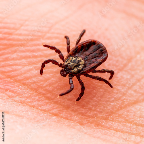 Encephalitis Virus or Lyme Borreliosis Disease Infectious Dermacentor Tick Arachnid Parasite Insect on Skin Macro