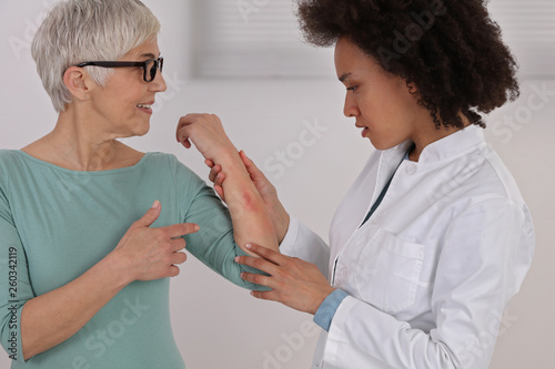 Fotografie Sensitive Skin, Food allergy symptoms, Irritation