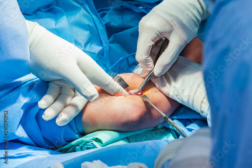 Group of orthopedic surgeons performing surgery on a patient arm