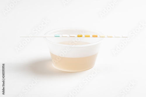 A set of urine sample on a round plastic cup with a single unused urine reagent strip against a plain white background.