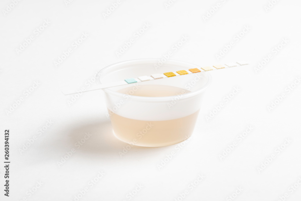 A set of urine sample on a round plastic cup with a single unused urine reagent strip against a plain white background. A set of urine sample on a round plastic cup with a single unused urine reagent strip against a plain white background.