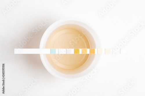 A set of urine sample on a round plastic cup with a single unused urine reagent strip against a plain white background.