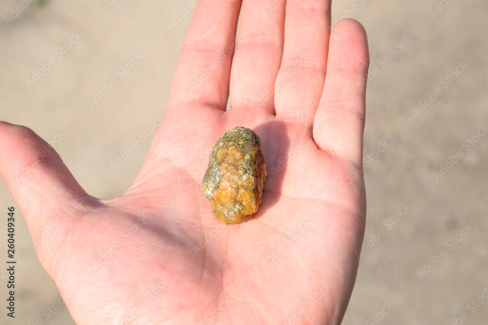 Gallstone in hand, Gall bladder stone. result of gallstones. Calculus of heterogeneous composition Gallstone in hand, Gall bladder stone. result of gallstones. Calculus of heterogeneous composition