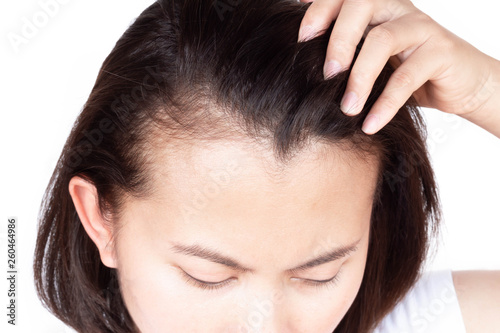 Woman serious hair loss problem for health care shampoo and beauty product concept, selective focus