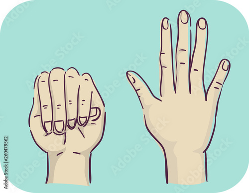 Hands Symptom Disproportion...