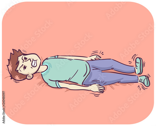 Man Myoclonic Seizures Illustration