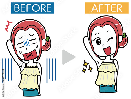 イラスト素材: エステ・女性のムダ毛処理・ビフォーアフター