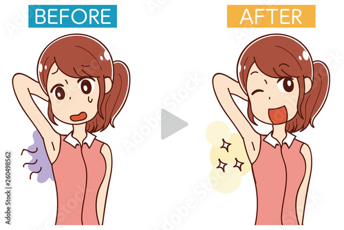 イラスト素材: 女性ワキのにおい・ビフォーアフター