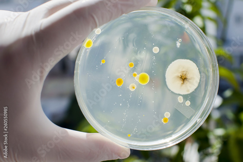 Researcher hand in glove holding Petri dish with colonies of different bacteria and molds on natural background. Biotechnology concept photo