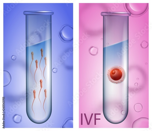 Male Test Tube with Sperm, Female Beaker with Egg