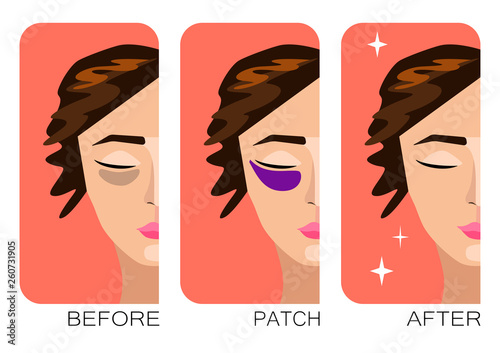Woman cartoon face with skin problems before after self or cosmetology care. Bruises under the eyes. Cosmetic effect of cream, mask, patches. Young girl character. Vector beauty concept illustration