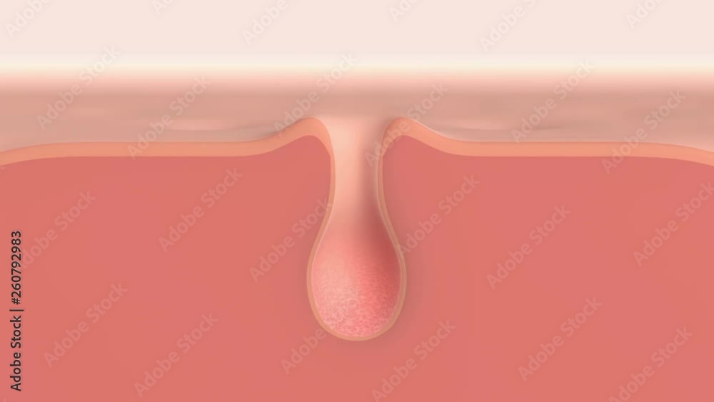 3D animation of a skin pore cleaning demo