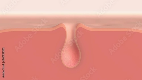 3D animation of a skin pore cleaning demo