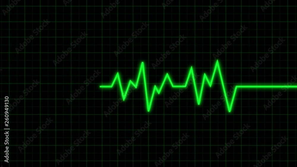 Heart beat cardiogram Heart beat cardiogram