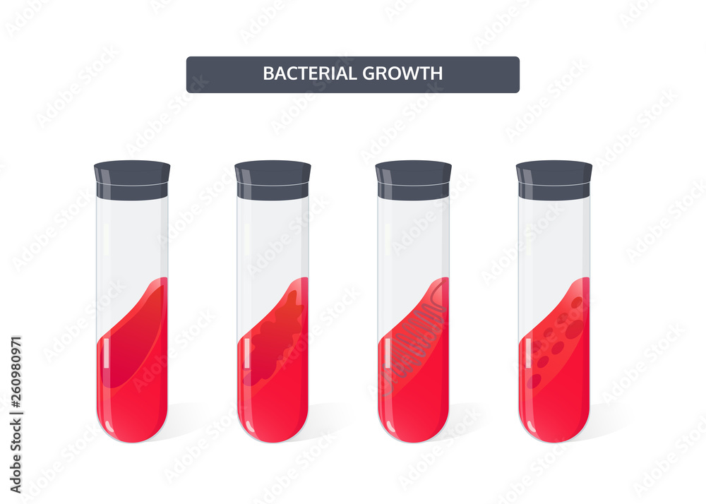 Growth of bacterial colonies in test tubes on a sloping nutrient medium