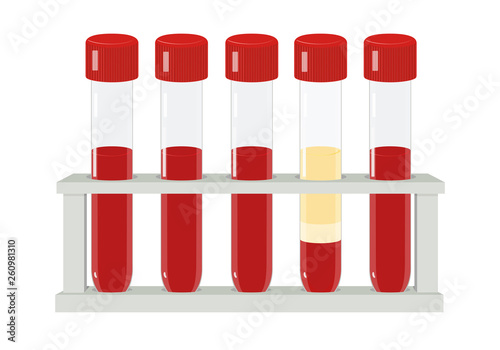 Several blood test tubes in holder. Vector flat concept.