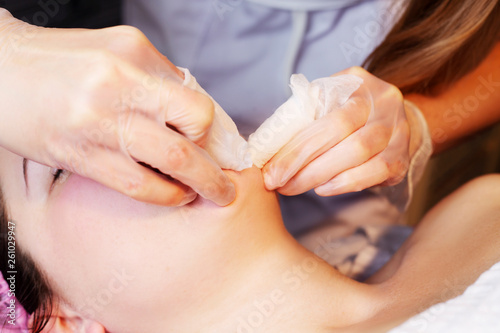 Depilation with hot wax mustache in the beauty salon. Young woman receiving facial epilation close up. Cosmetologist removes hair on face. Beauty salon, mustache depilation