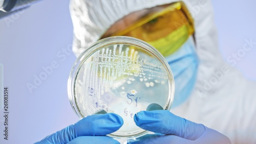 Close-up shot of microbiologist looking at a Petri dish with bacteria through light.