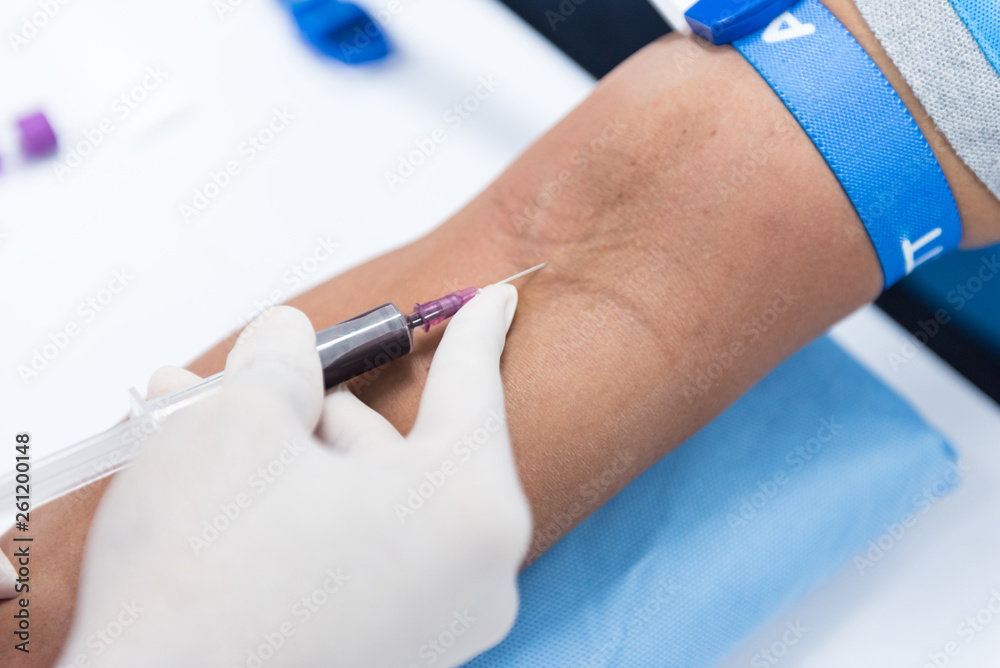 Obraz premium Close up nurse pricking needle into the patient arm for blood chemistry test.Laboratory with technician collecting a blood sample from patient.Medical analysis concept