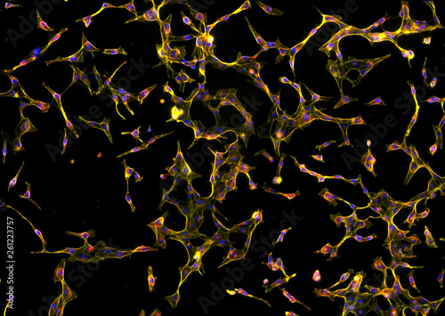 Real fluorescence microscopic view of human skin fibroblasts