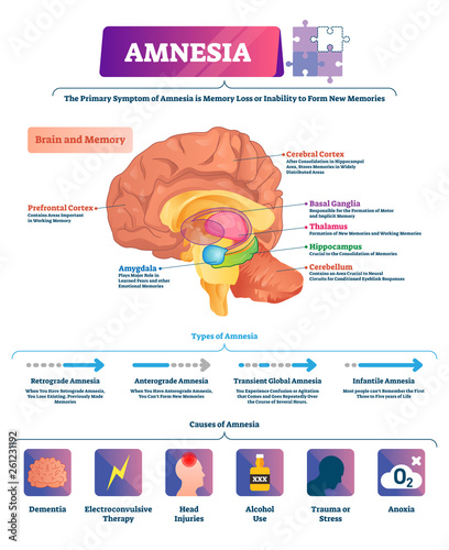 Amnesia vector illustration. Labeled brain memory loss disease types scheme