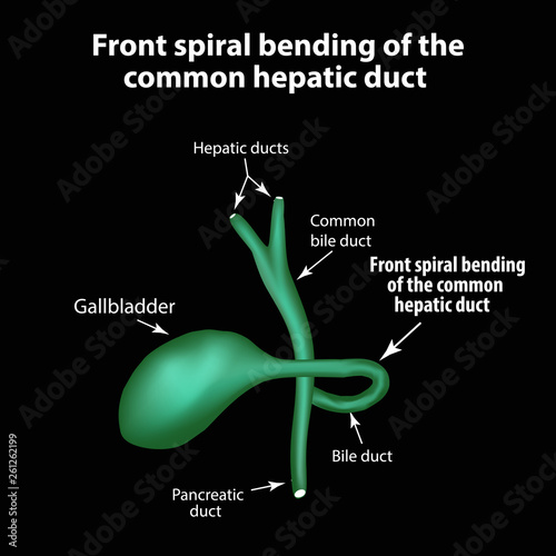 Front spiral bending of the common hepatic duct. Pathology of the gallbladder. Cholecystitis. The structure of the gallbladder. Infographics. Vector illustration