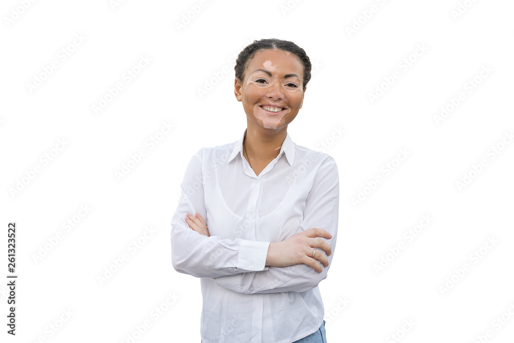 A beautiful young girl of African ethnicity with vitiligo isolated on the white background A beautiful young girl of African ethnicity with vitiligo isolated on the white background