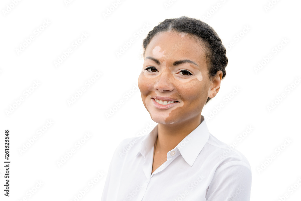 A beautiful young girl of African ethnicity with vitiligo isolated on the white background A beautiful young girl of African ethnicity with vitiligo isolated on the white background