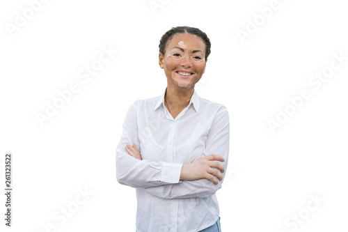 A beautiful young girl of African ethnicity with vitiligo isolated on the white background