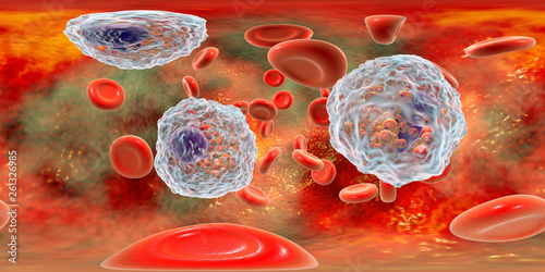 360-degree spherical panorama of blood with eosinophilia showing multiple eosinophils surrounded by red blood cells, 3D illustration photo