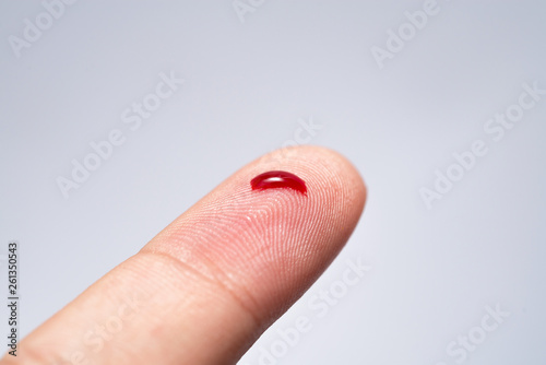 Bleeding blood from the cut finger wound. Injured finger with bleeding open cut wound. Closeup of finger human hand is cut hurt bleeding with bright red blood. 