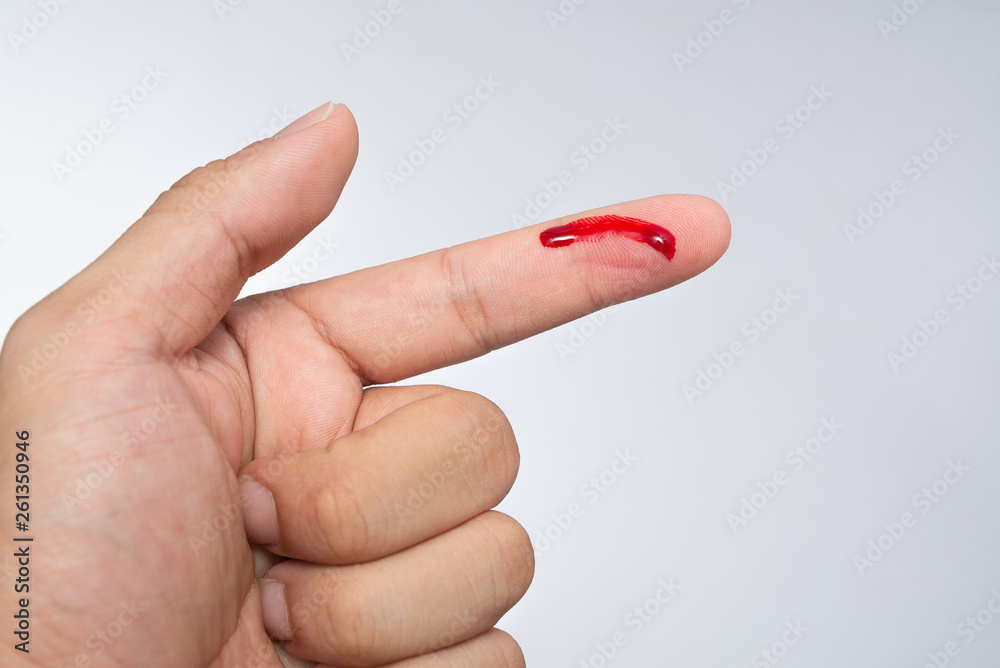 Bleeding blood from the cut finger wound. Injured finger with bleeding